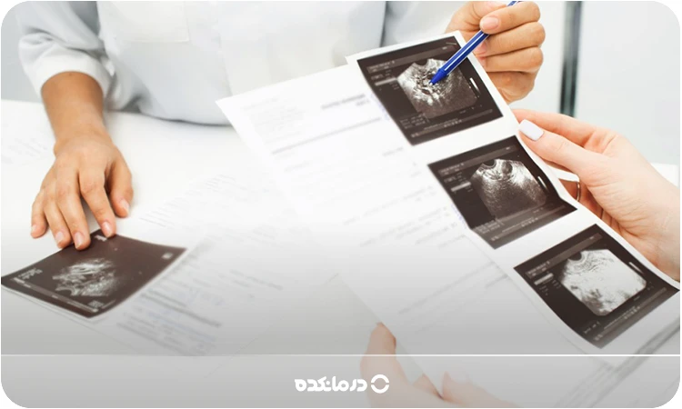 اکوژن در سونوگرافی چیست؟ [۵ نوع، روش تشخیص + علت ایجاد]