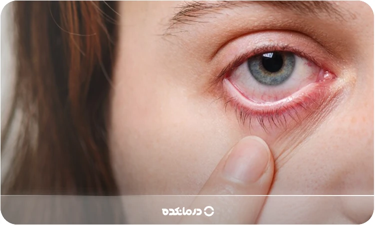 سرطان چشم چیست؟ [علائم، انواع و تصاویر + ۷ روش درمان]